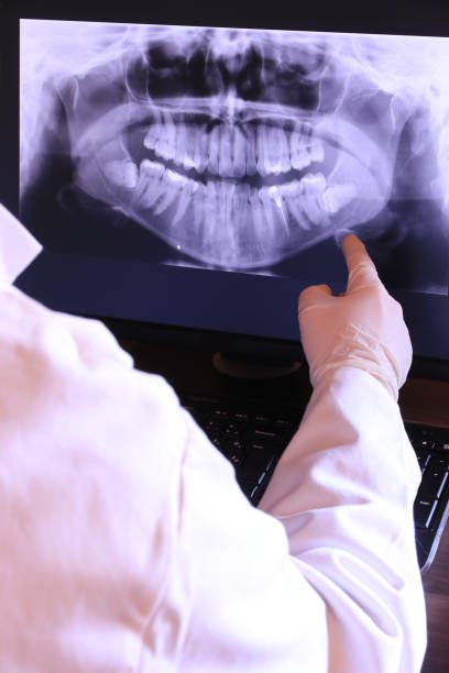 Best Emergency Dental Care for Broken or Chipped Teeth in West Simsbury, CT