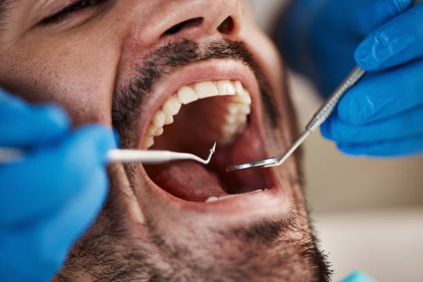 Best Weekend Emergency Dentist in West Simsbury, CT