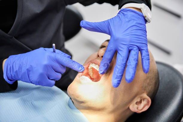 Best Emergency Treatment for Dental Infections or Abscesses in West Simsbury, CT